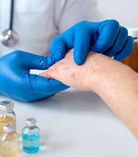 Laser skin treatment Bangalore