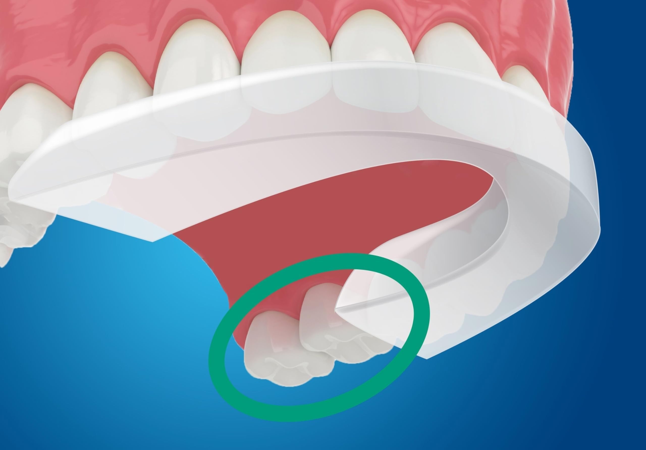 Sleep protection dental guard