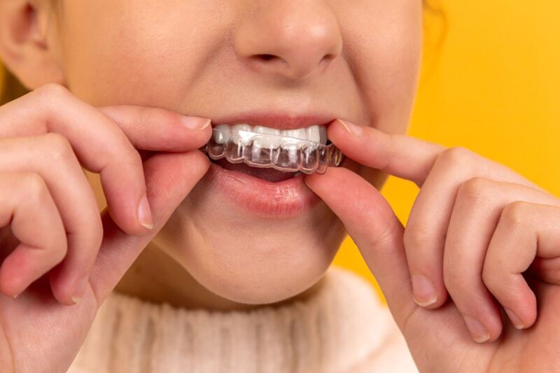 Oral Prophylaxis