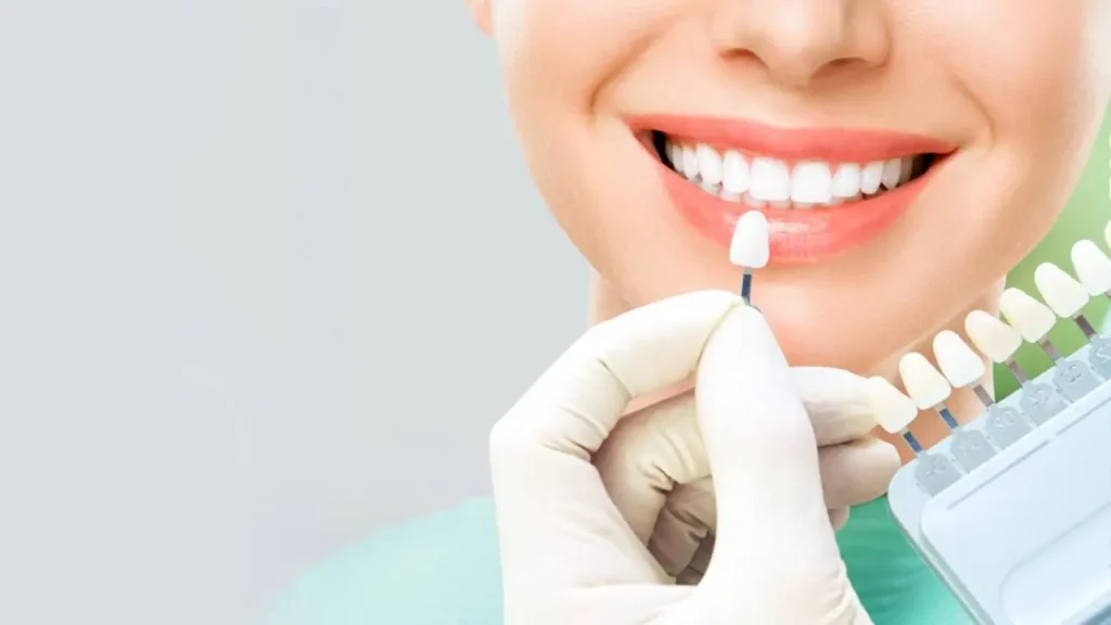 Smile Makeover Bangalore