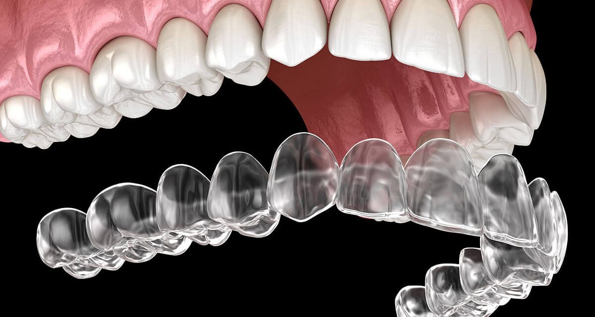 Orthodontic Smile Results